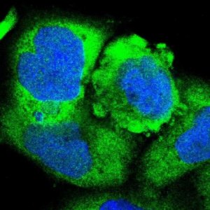 Anti-RARS antibody produced in rabbit 