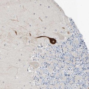 Anti-RASA2 antibody produced in rabbit 