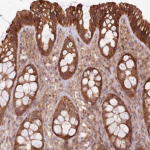 Anti-RASA3 antibody produced in rabbit 