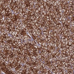 Anti-RASAL1 antibody produced in rabbit 