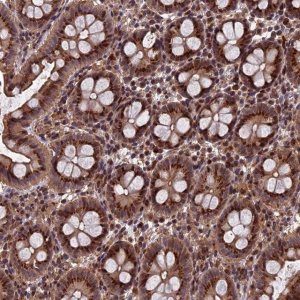 Anti-RASGRF1 antibody produced in rabbit 