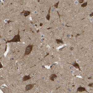 Anti-RASGRF2 antibody produced in rabbit 