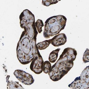 Anti-RASGRF2 antibody produced in rabbit 