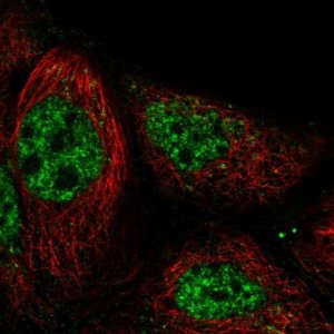 Anti-RASGRP3 antibody produced in rabbit 