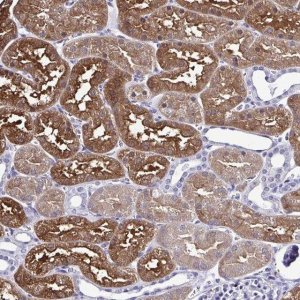 Anti-RASL11B antibody produced in rabbit 