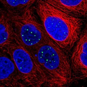 Anti-RASL11B antibody produced in rabbit 