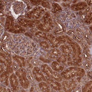 Anti-RASSF2 antibody produced in rabbit 