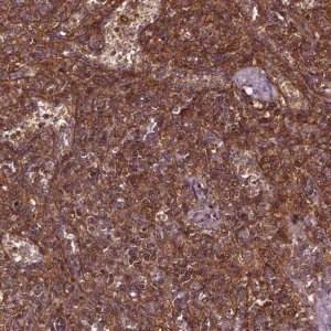 Anti-RASSF5 antibody produced in rabbit 