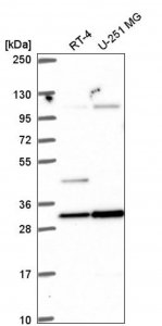 Anti-RASSF5 antibody produced in rabbit 