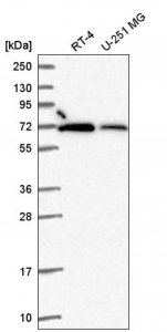 Anti-RBBP5 antibody produced in rabbit 