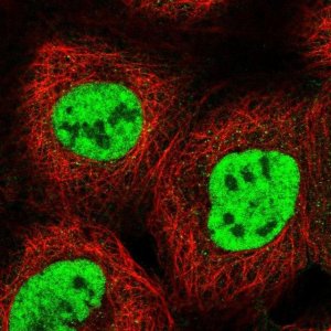 Anti-RBM15 antibody produced in rabbit 