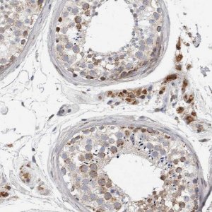 Anti-RBM48 antibody produced in rabbit 