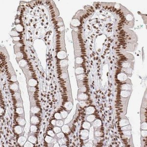 Anti-RBMX antibody produced in rabbit HPA057707-100UL