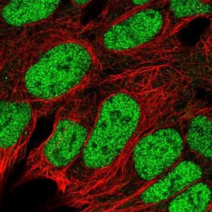 Anti-RBX1 antibody produced in rabbit 