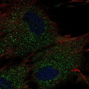 Anti-RC3H2 antibody produced in rabbit 