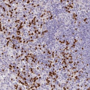 Anti-RCAN2 antibody produced in rabbit 