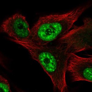Anti-RCAN3 antibody produced in rabbit 