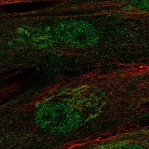 Anti-RCBTB2 antibody produced in rabbit HPA040242-100UL
