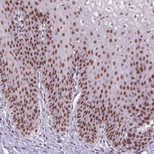 Anti-RCC2 antibody produced in rabbit 