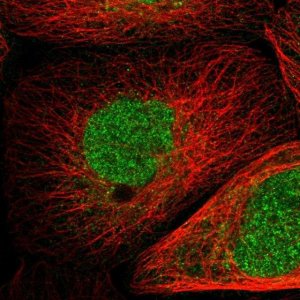 Anti-RCHY1 antibody produced in rabbit 