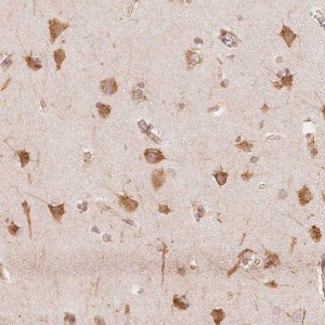 Anti-RCN3 antibody produced in rabbit 