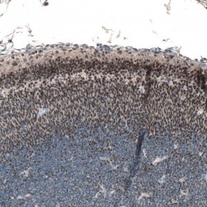 Anti-RCOR2 antibody produced in rabbit 