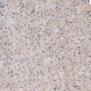 Anti-RCOR2 antibody produced in rabbit 