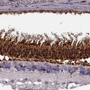 Anti-RCVRN antibody produced in rabbit 