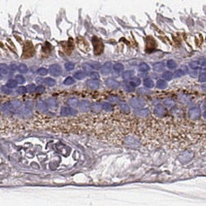 Anti-RDH13 antibody produced in rabbit 