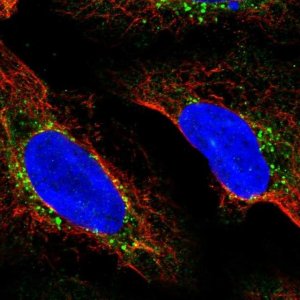Anti-RDH5 antibody produced in rabbit 