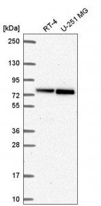 Anti-RECQL antibody produced in rabbit 