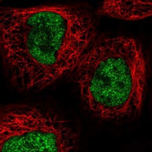 Anti-RECQL4 antibody produced in rabbit 