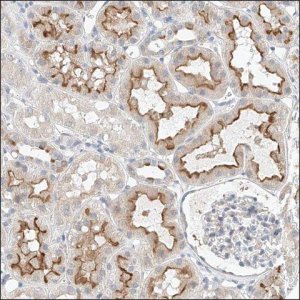 Anti-RECQL5 antibody produced in rabbit HPA029970-100UL