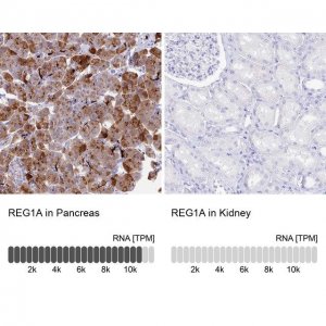 Anti-REG1A antibody produced in rabbit 