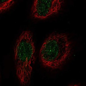 Anti-RELT antibody produced in rabbit 