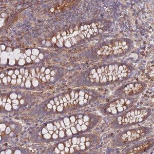 Anti-REM1 antibody produced in rabbit 