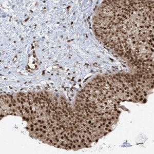 Anti-REPIN1 antibody produced in rabbit 