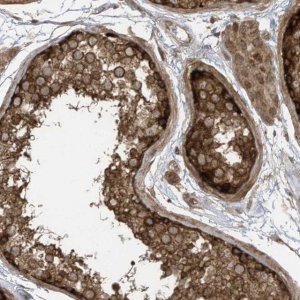 Anti-REPS1 antibody produced in rabbit 
