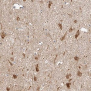 Anti-RERE antibody produced in rabbit 