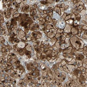 Anti-RET antibody produced in rabbit 