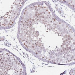 Anti-REXO4 antibody produced in rabbit 