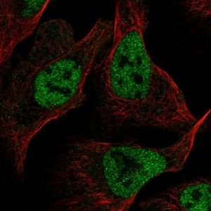 Anti-RFC1 antibody produced in rabbit 