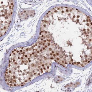 Anti-RFC5 antibody produced in rabbit 