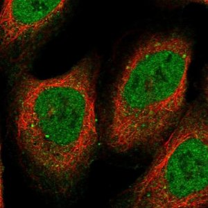 Anti-RFC5 antibody produced in rabbit 