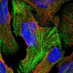 Anti-RFLNB antibody produced in rabbit 