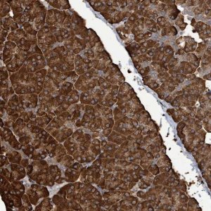Anti-RFPL4A antibody produced in rabbit 