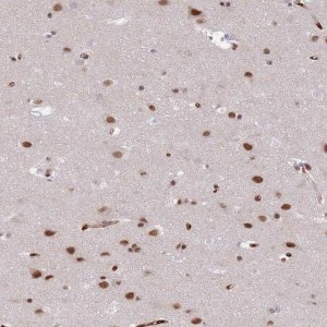 Anti-RFX1 antibody produced in rabbit 