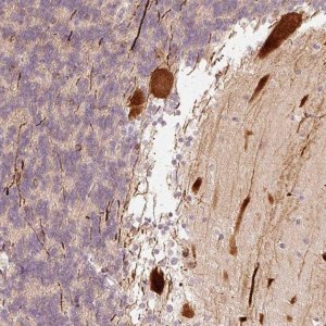 Anti-RGPD5 antibody produced in rabbit 