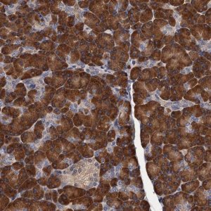 Anti-RGS11 antibody produced in rabbit 