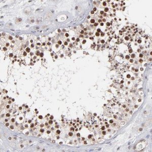 Anti-RGS6 antibody produced in rabbit 